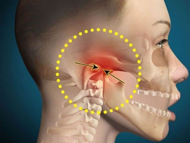 Understanding TMJ Disorder: Causes, Symptoms, and Effective Treatment Options Understanding TMJ Disorder: Causes, Symptoms, and Effective Treatment Options